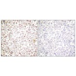 Immunohistochemistry - Anti-OCT1 Antibody (C0281) - Antibodies.com