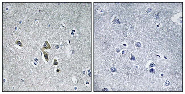 Immunohistochemical analysis of paraffin-embedded human brain tissue using Anti-OAZ1 Antibody. The right hand panel represents a negative control, where the antibody was pre-incubated with the immunising peptide.