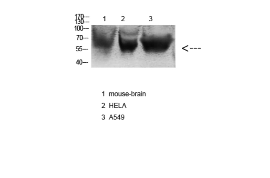 Western Blot - Anti-NOX3 Antibody (C16865) - Antibodies.com