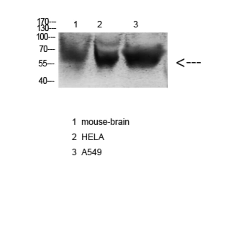 Western Blot - Anti-NOX3 Antibody (C16865) - Antibodies.com