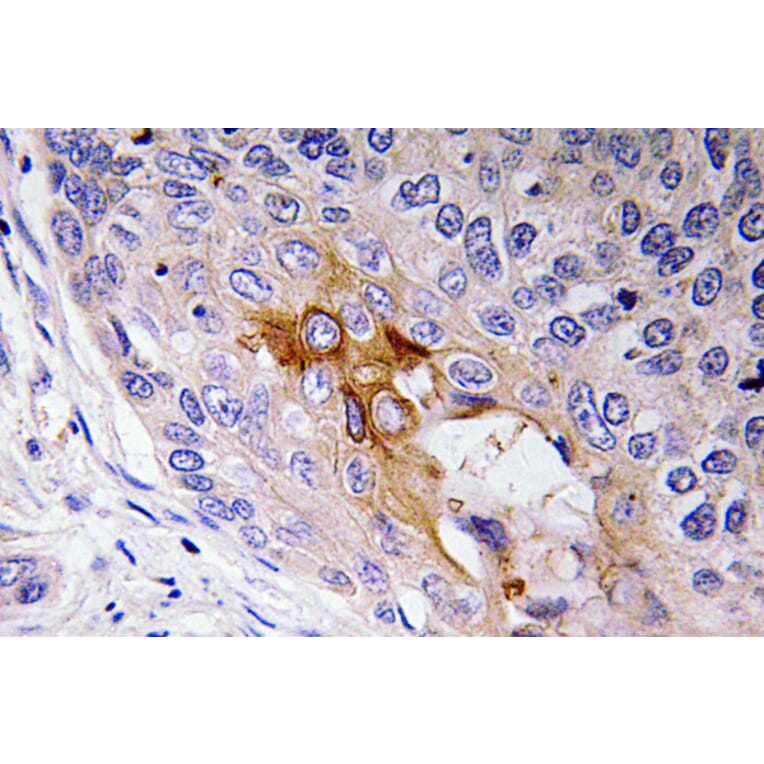 Immunohistochemistry - Anti-NF-L Antibody (R12-2262) - Antibodies.com