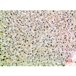 Immunohistochemistry - Anti-MSR1 Antibody (C30539) - Antibodies.com