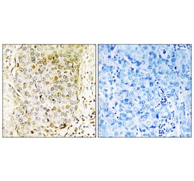 Immunohistochemistry - Anti-MLK3 Antibody (B8375) - Antibodies.com