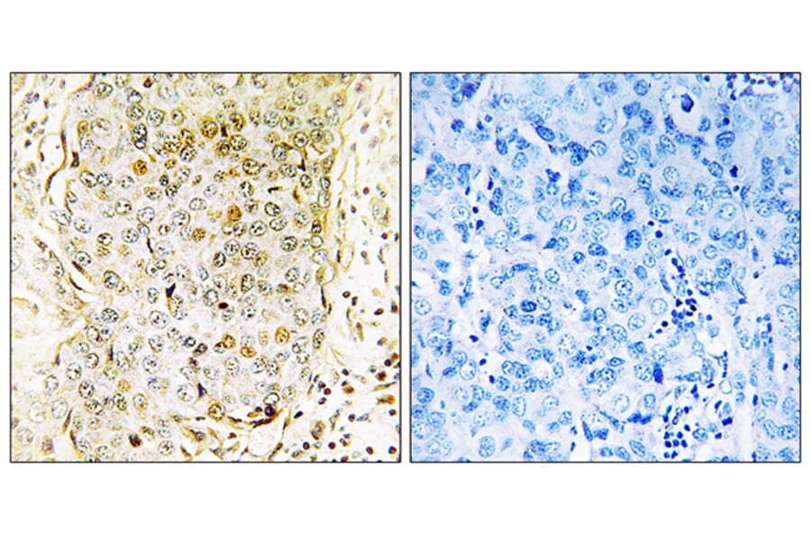Immunohistochemistry - Anti-MLK3 Antibody (B8375) - Antibodies.com