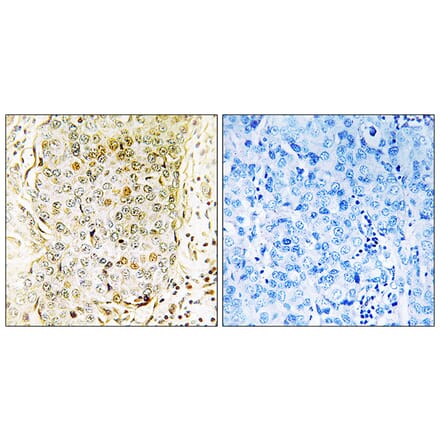 Immunohistochemistry - Anti-MLK3 Antibody (B8375) - Antibodies.com