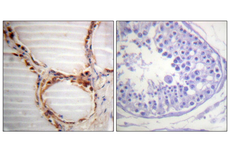 Immunohistochemistry - Anti-MCM4 Antibody (B0905) - Antibodies.com