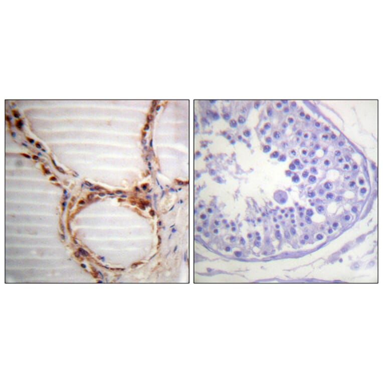 Immunohistochemistry - Anti-MCM4 Antibody (B0905) - Antibodies.com