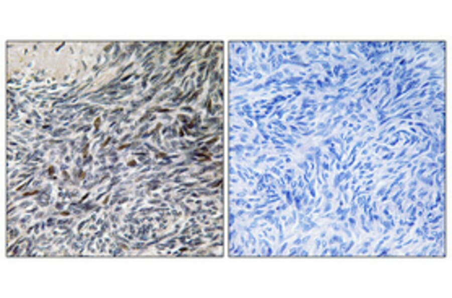 Immunohistochemistry - Anti-MCM4 Antibody (B0905) - Antibodies.com