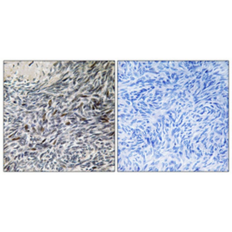 Immunohistochemistry - Anti-MCM4 Antibody (B0905) - Antibodies.com