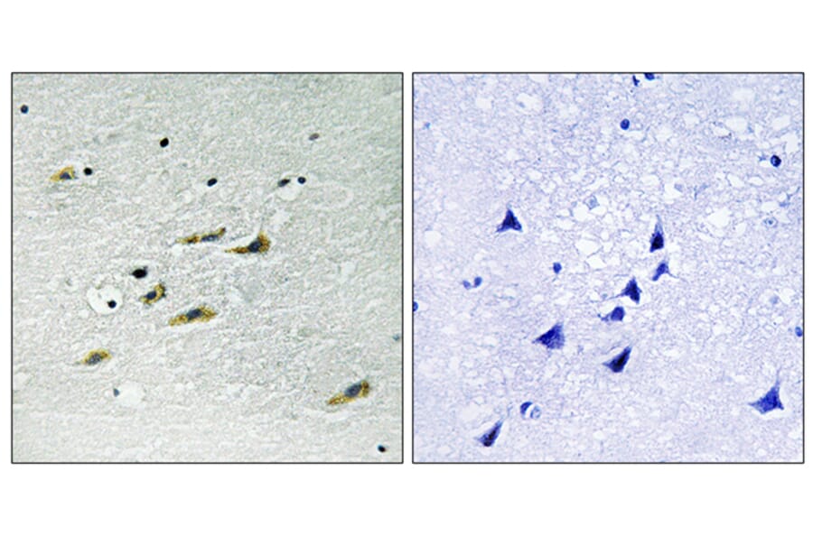 Immunohistochemistry - Anti-JAK2 Antibody (B8118) - Antibodies.com