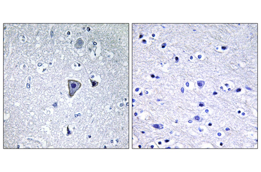 Immunohistochemistry - Anti-GRM1 Antibody (G363) - Antibodies.com