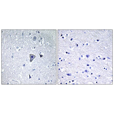 Immunohistochemistry - Anti-GRM1 Antibody (G363) - Antibodies.com