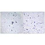 Immunohistochemistry - Anti-GRM1 Antibody (G363) - Antibodies.com