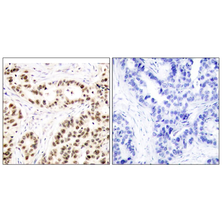 Immunohistochemistry - Anti-Elk1 Antibody (B7070) - Antibodies.com