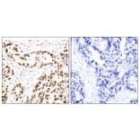 Immunohistochemistry - Anti-Elk1 Antibody (B7070) - Antibodies.com