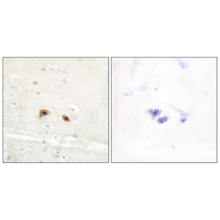 Immunohistochemistry - Anti-EGR3 Antibody (C10897) - Antibodies.com