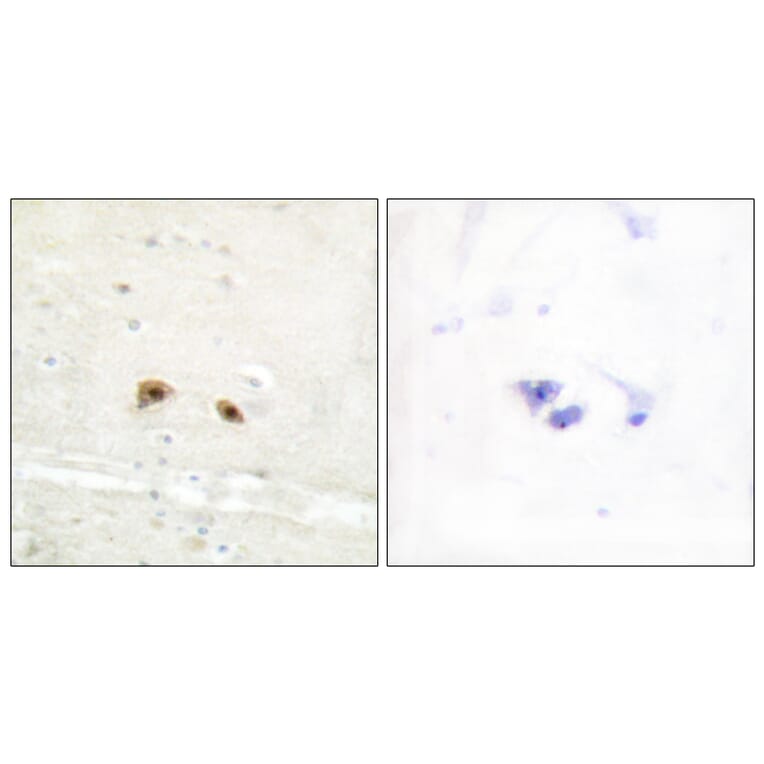 Immunohistochemistry - Anti-EGR3 Antibody (C10897) - Antibodies.com