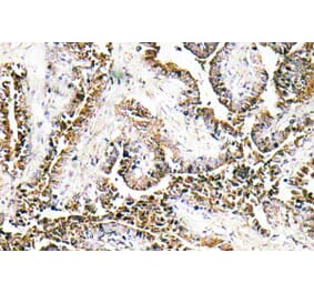 Immunohistochemistry - Anti-CLN1 Antibody (R12-2094) - Antibodies.com