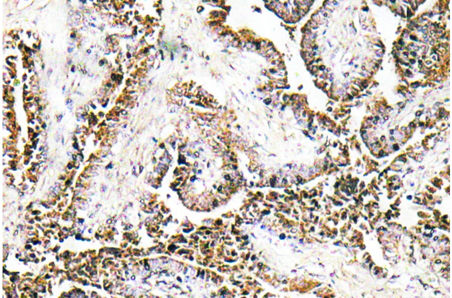 Immunohistochemistry - Anti-CLN1 Antibody (R12-2094) - Antibodies.com