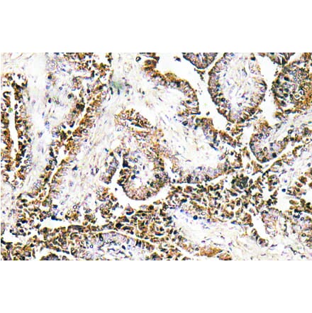 Immunohistochemistry - Anti-CLN1 Antibody (R12-2094) - Antibodies.com