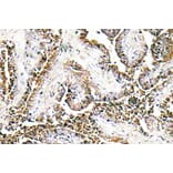 Immunohistochemistry - Anti-CLN1 Antibody (R12-2094) - Antibodies.com