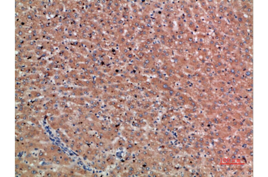 Immunohistochemistry - Anti-CHRD Antibody (C30892) - Antibodies.com