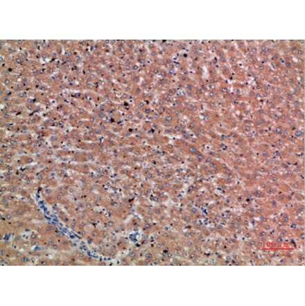 Immunohistochemistry - Anti-CHRD Antibody (C30892) - Antibodies.com