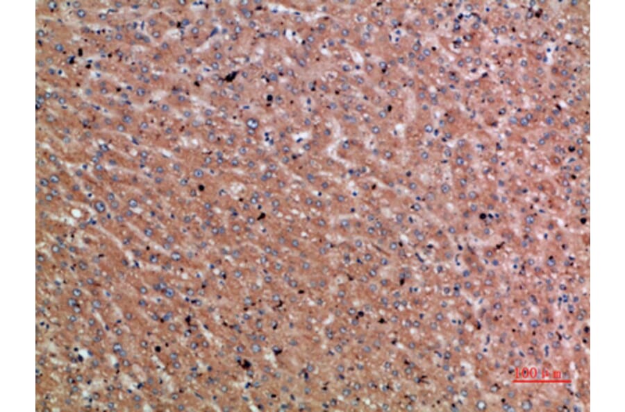 Immunohistochemistry - Anti-CHRD Antibody (C30892) - Antibodies.com