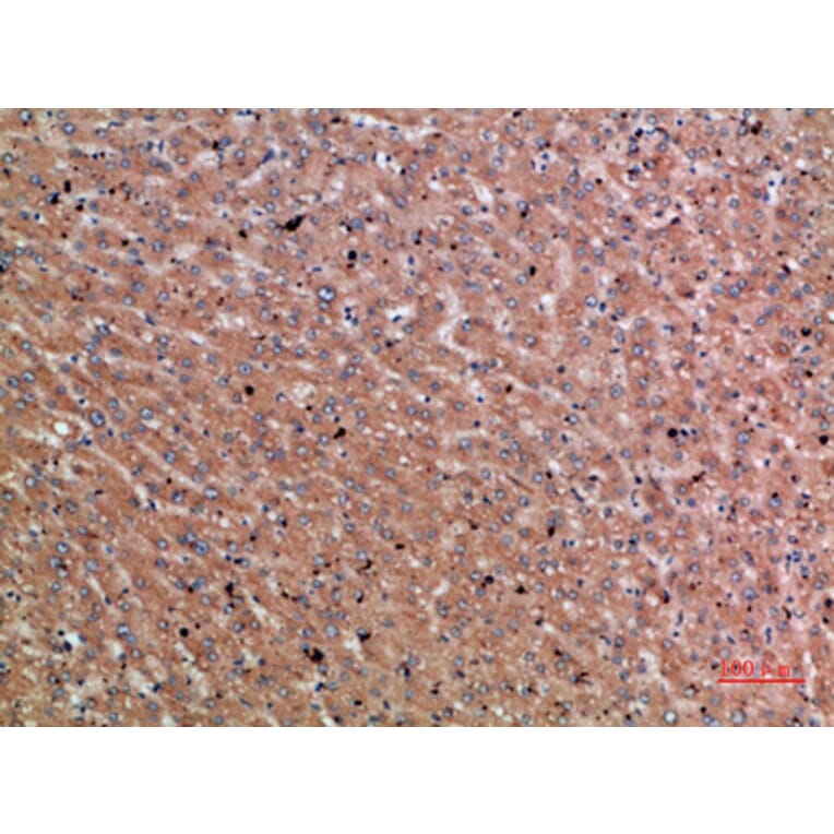 Immunohistochemistry - Anti-CHRD Antibody (C30892) - Antibodies.com