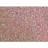 Immunohistochemistry - Anti-CHRD Antibody (C30892) - Antibodies.com