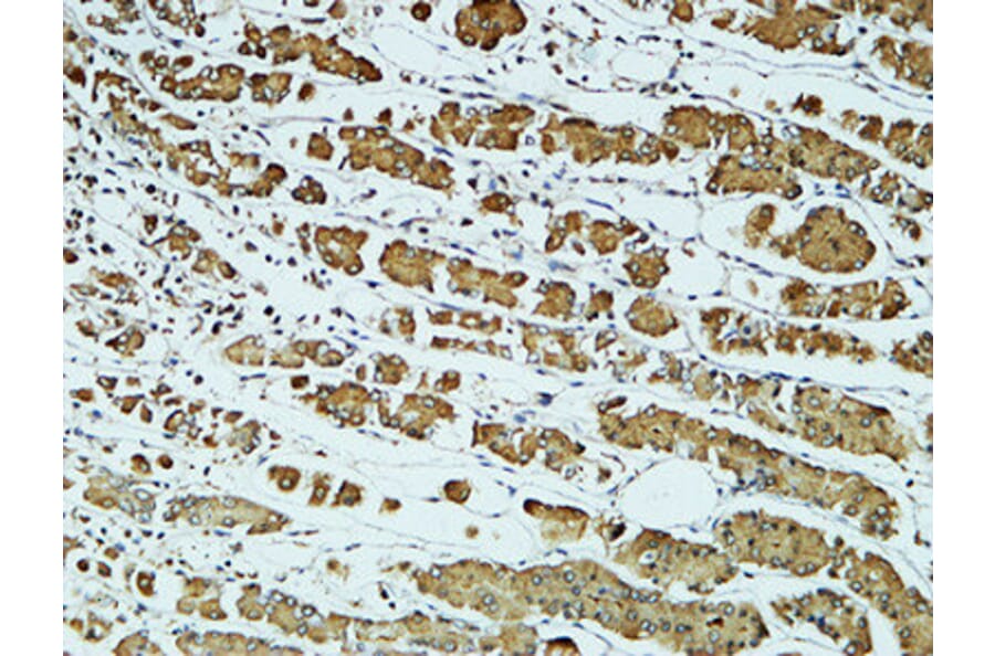 Immunohistochemistry - Anti-CD57 Antibody (R12-2080) - Antibodies.com