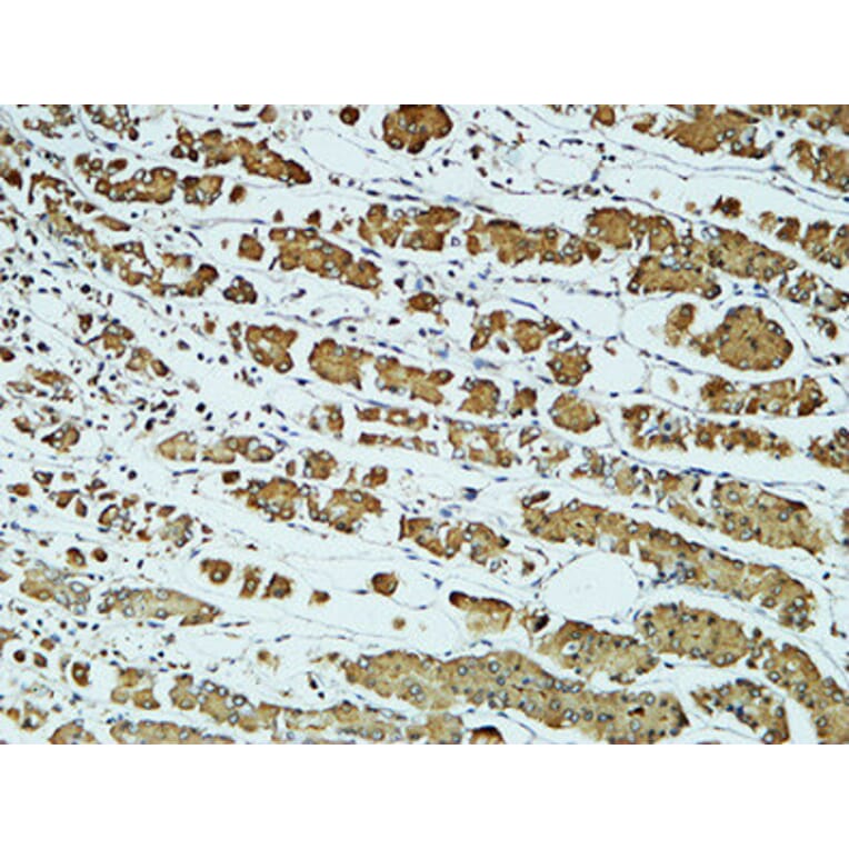 Immunohistochemistry - Anti-CD57 Antibody (R12-2080) - Antibodies.com