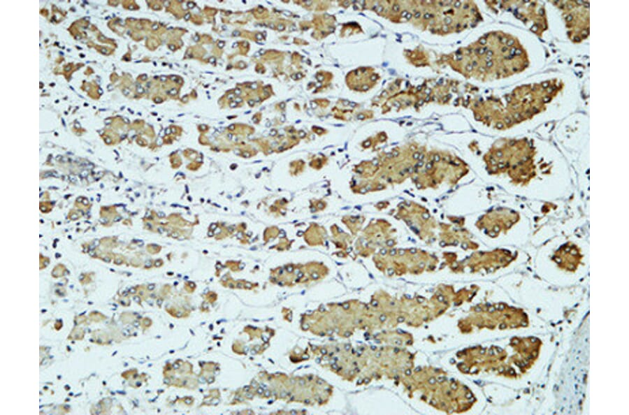 Immunohistochemistry - Anti-CD57 Antibody (R12-2080) - Antibodies.com