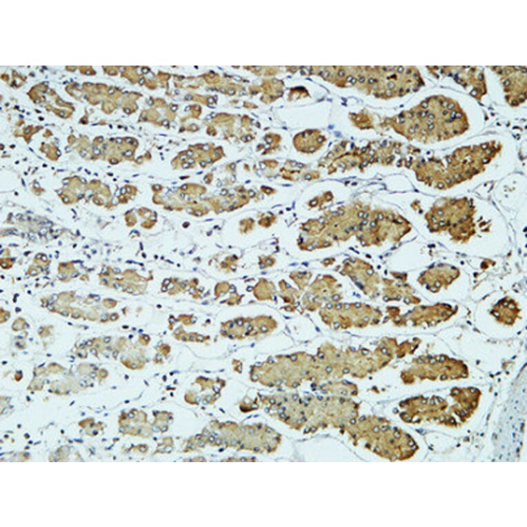 Immunohistochemistry - Anti-CD57 Antibody (R12-2080) - Antibodies.com