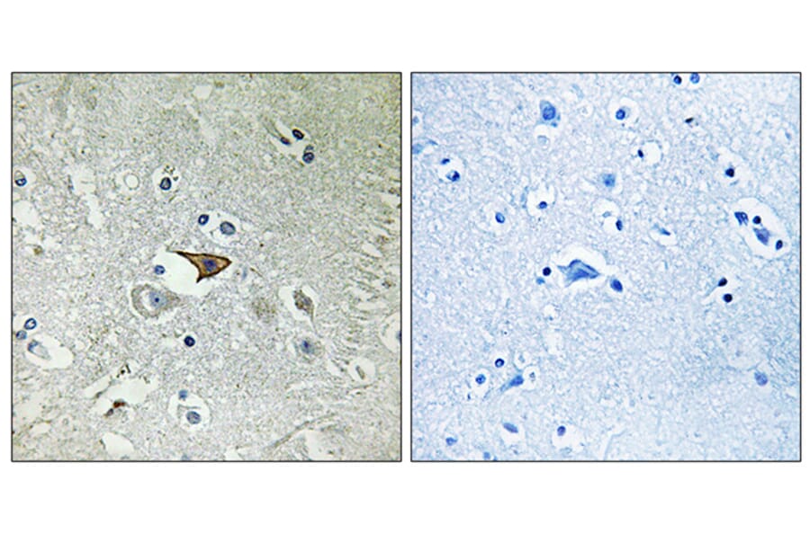 Immunohistochemistry - Anti-CCR5 Antibody (B0061) - Antibodies.com