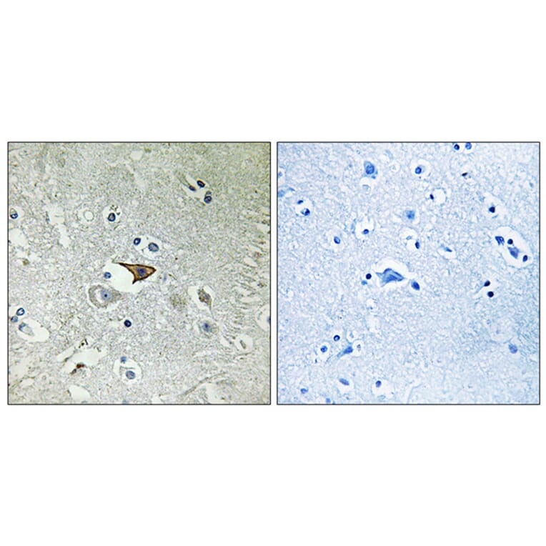 Immunohistochemistry - Anti-CCR5 Antibody (B0061) - Antibodies.com