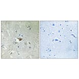 Immunohistochemistry - Anti-CCR5 Antibody (B0061) - Antibodies.com