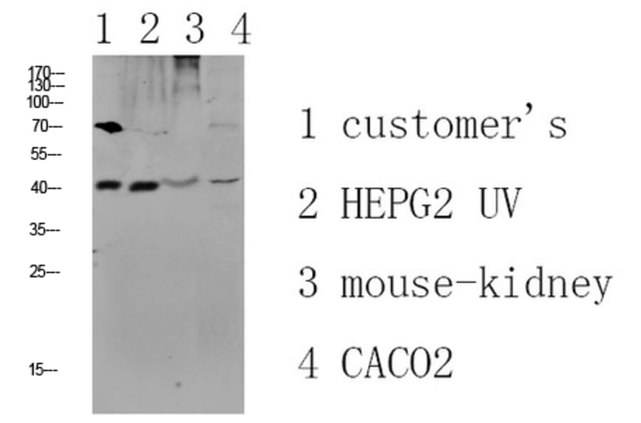Western Blot - Anti-CCR5 Antibody (B0061) - Antibodies.com