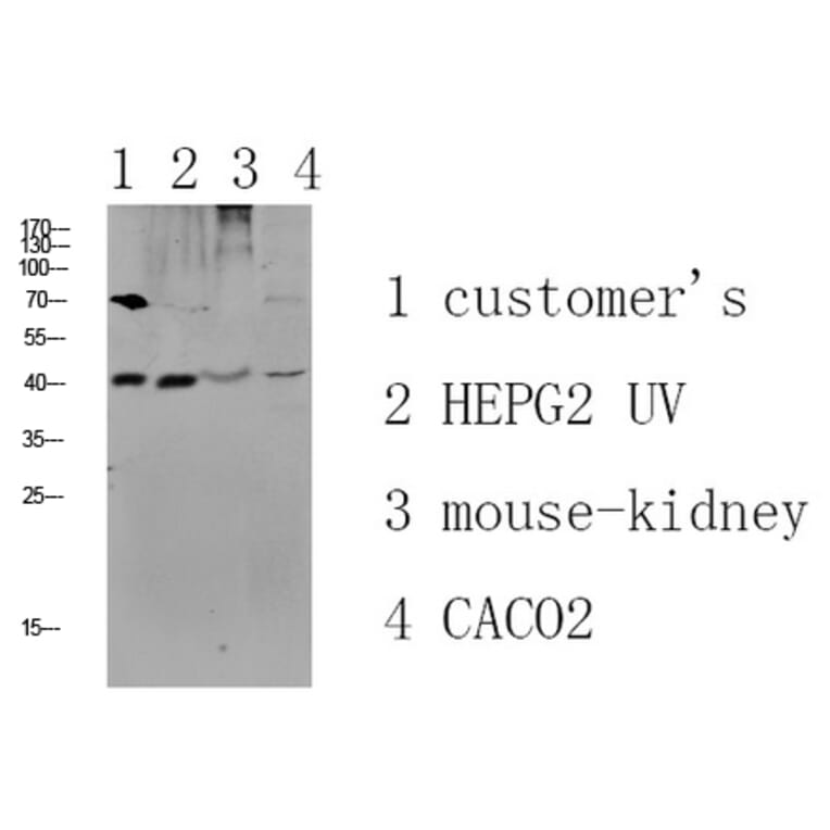 Western Blot - Anti-CCR5 Antibody (B0061) - Antibodies.com