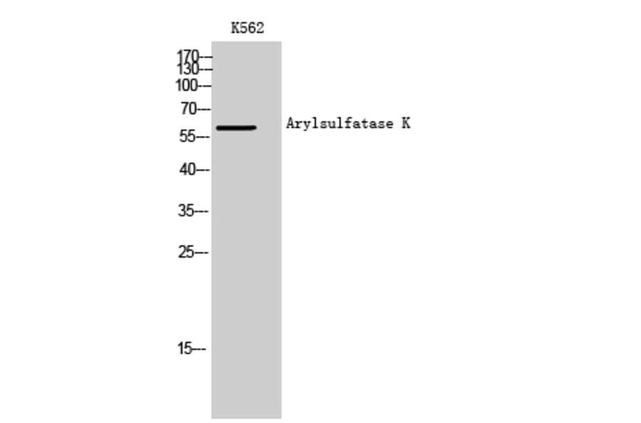 Western Blot - Anti-ARSK Antibody (C14573) - Antibodies.com