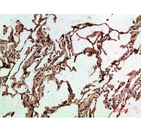 Immunohistochemistry - Anti-ADI1 Antibody (C31073) - Antibodies.com