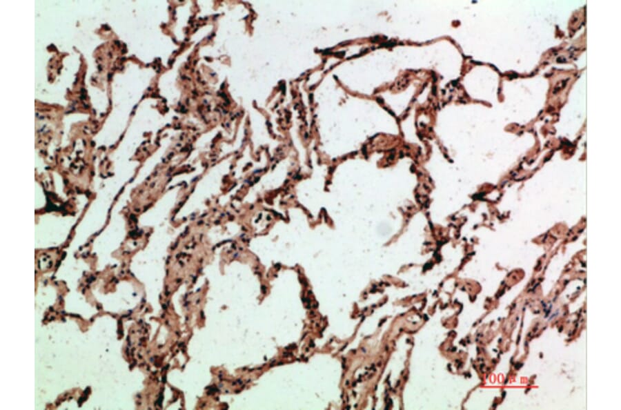 Immunohistochemistry - Anti-ADI1 Antibody (C31073) - Antibodies.com