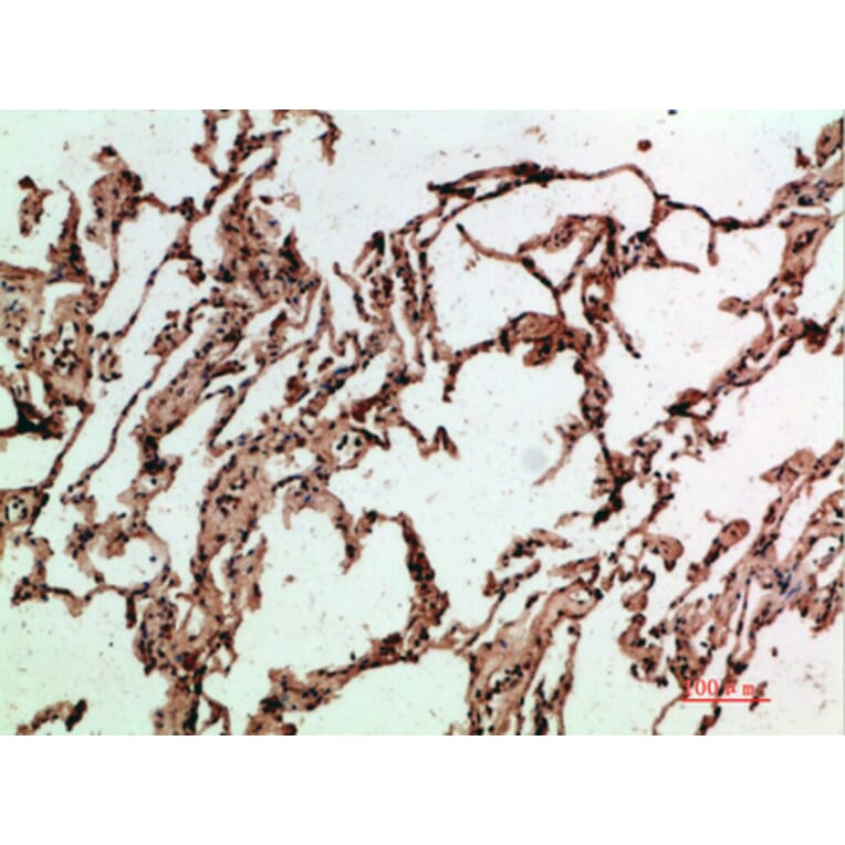 Immunohistochemistry - Anti-ADI1 Antibody (C31073) - Antibodies.com