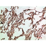 Immunohistochemistry - Anti-ADI1 Antibody (C31073) - Antibodies.com