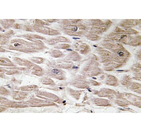 Immunohistochemistry - Anti-Defensin alpha4 Antibody (R12-2114) - Antibodies.com