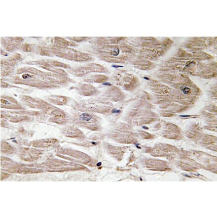 Immunohistochemistry - Anti-Defensin alpha4 Antibody (R12-2114) - Antibodies.com