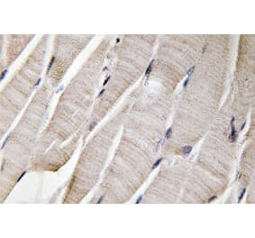 Immunohistochemistry - Anti-Defensin alpha3 Antibody (R12-2113) - Antibodies.com