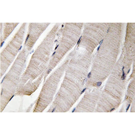 Immunohistochemistry - Anti-Defensin alpha3 Antibody (R12-2113) - Antibodies.com