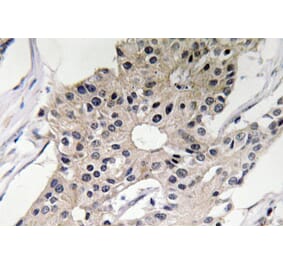 Immunohistochemistry - Anti-Defensin alpha1 Antibody (R12-2112) - Antibodies.com