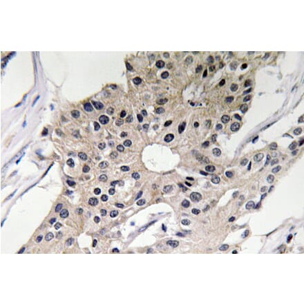 Immunohistochemistry - Anti-Defensin alpha1 Antibody (R12-2112) - Antibodies.com